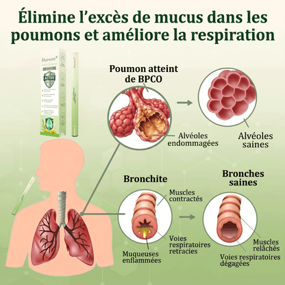 🇨🇦 Fièrement fabriqué et expédié au Canada✅𝑴𝒖𝒓𝙬𝙤𝐧® 𝑫𝒊𝒇𝒇𝒖𝒔𝒆𝒖𝒓 𝒅𝒆 𝑵𝒆𝒕𝒕𝒐𝒚𝒂𝒈𝒆 𝑷𝒖𝒍𝒎𝒐𝒏𝒂𝒊𝒓𝒆 à 𝒍𝒂 𝑴𝒐𝒍è𝒏𝒆 𝑩𝒐𝒕𝒂𝒏𝒊𝒒𝒖𝒆 (🫁 Toux, Pharyngite, essoufflement, expectorations, nez bouché, bronchite, symptômes allergiques, gêne pulmonaire)1❤️
