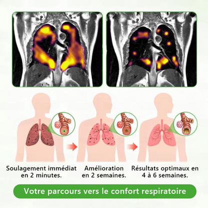 Détenu et exploité par le Canada✅ 𝑴𝒖𝒓𝙬𝙤𝐧® 𝑫𝒊𝒇𝒇𝒖𝒔𝒆𝒖𝒓 𝒅𝒆 𝑵𝒆𝒕𝒕𝒐𝒚𝒂𝒈𝒆 𝑷𝒖𝒍𝒎𝒐𝒏𝒂𝒊𝒓𝒆 à 𝒍𝒂 𝑴𝒐𝒍è𝒏𝒆 𝑩𝒐𝒕𝒂𝒏𝒊𝒒𝒖𝒆 (🫁 Toux, Pharyngite, essoufflement, expectorations, nez bouché, bronchite, symptômes allergiques, gêne pulmonaire)1✨